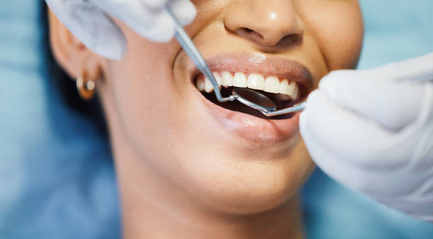 Best Emergency Wisdom Tooth Extraction in Chippewa Falls, WI